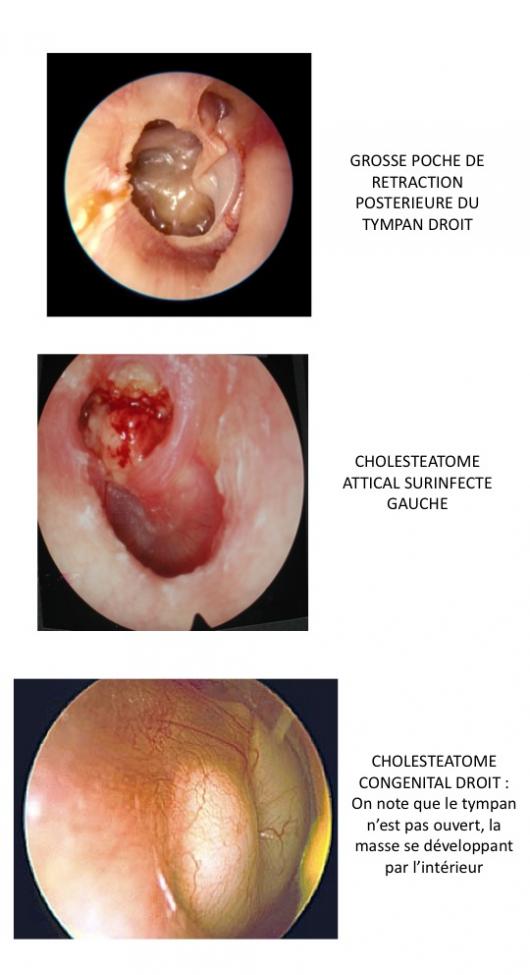 Diapositive3