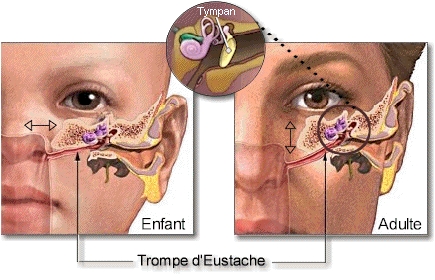 Trompe eustache